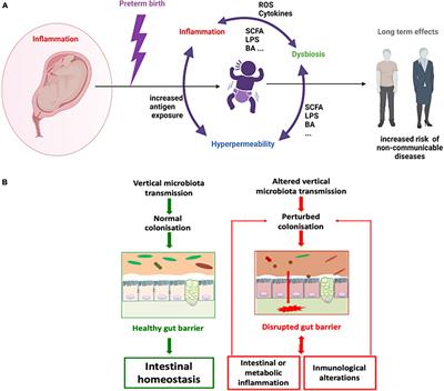 Preterm Delivery: Microbial Dysbiosis, Gut Inflammation and Hyperpermeability